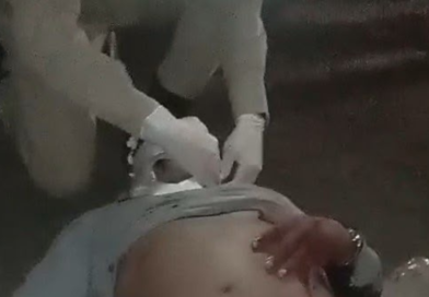 Mulher e homem ficam feridos após moto ser atingida por carro na AM-070
