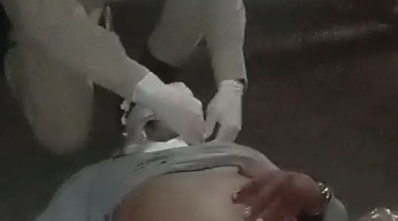 Mulher e homem ficam feridos após moto ser atingida por carro na AM-070